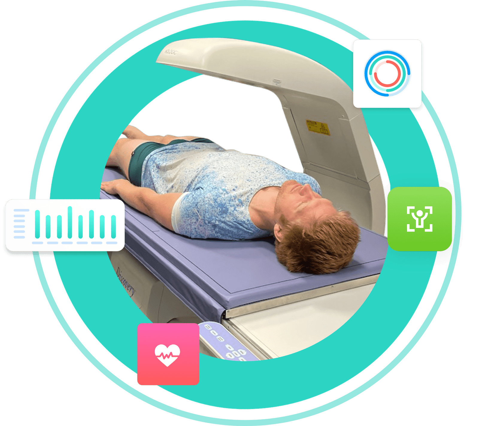 DEXA Scans