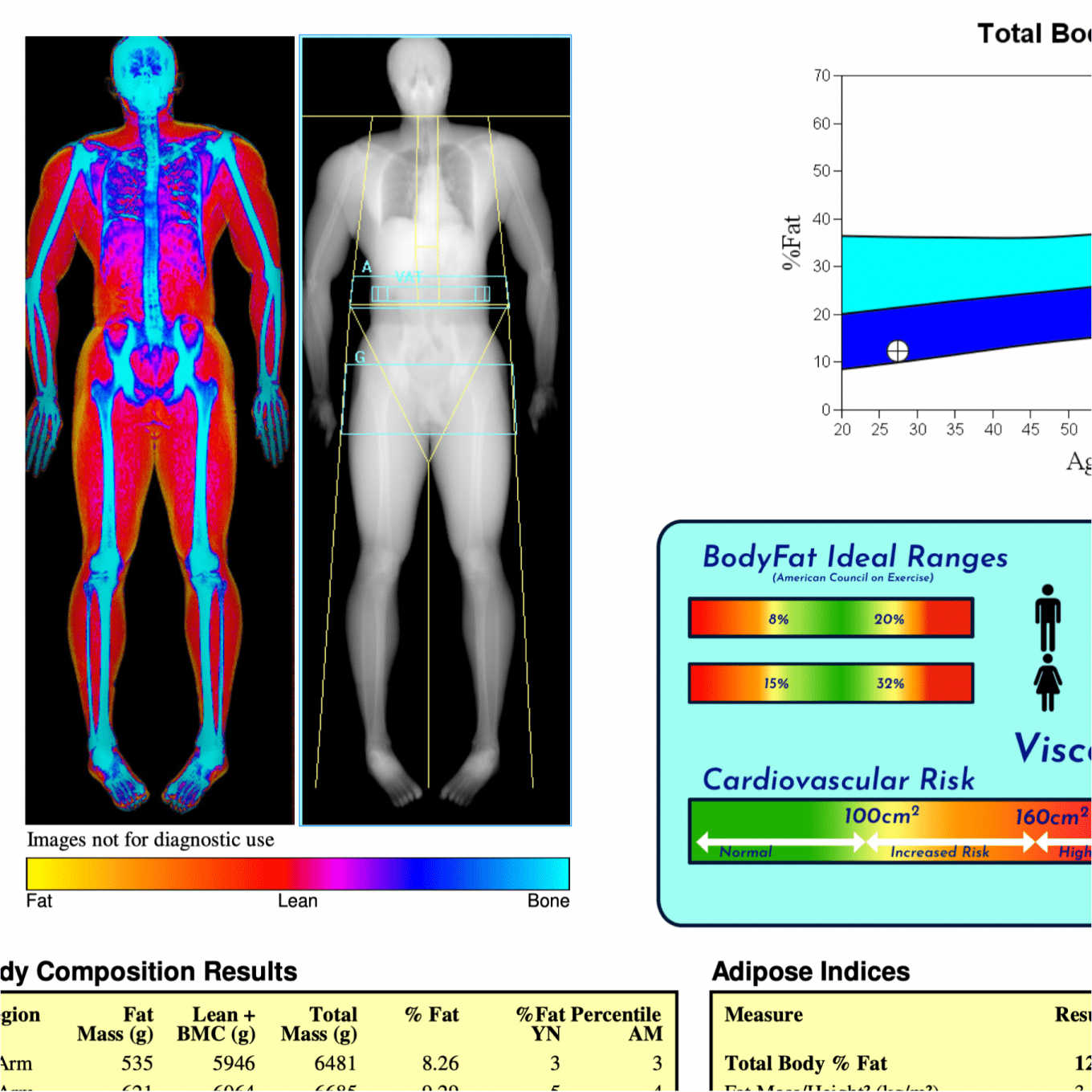 dexa scan report blog image